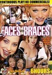 Faces with Braces - 6 Stunden (Leisure Time)